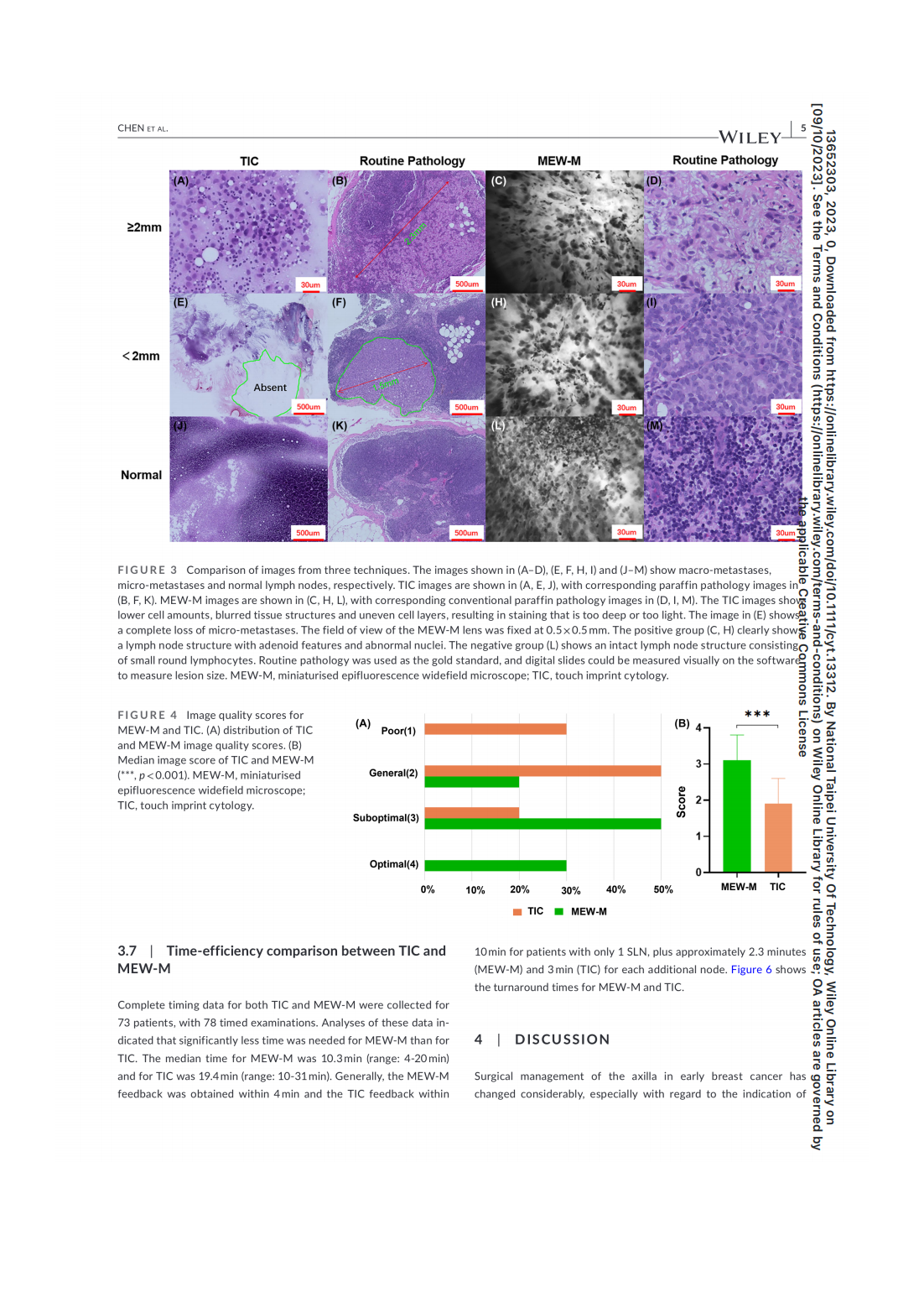 A prospective comparison of a modified miniaturised hand-held epifluorescence microscope and touch imprint cytologyfor evaluation of axillary sentinel lymph nodes intraoperativelyin breast cancer pati(圖5)