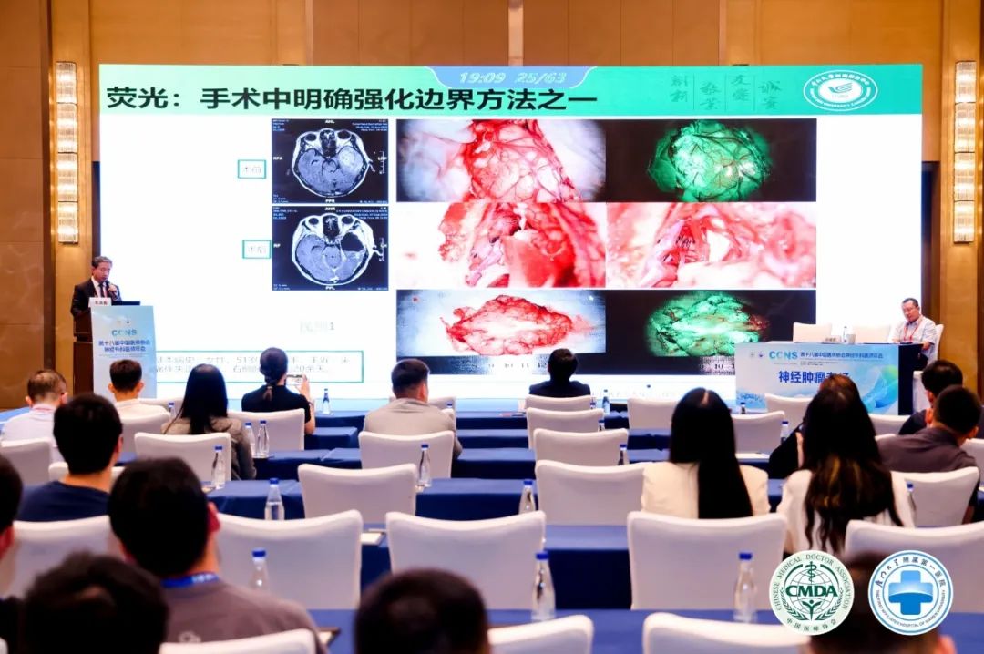 腦膠質瘤治療新曙光：EndoSCell?細胞級精準手術方案亮相2024CCNS(圖4)