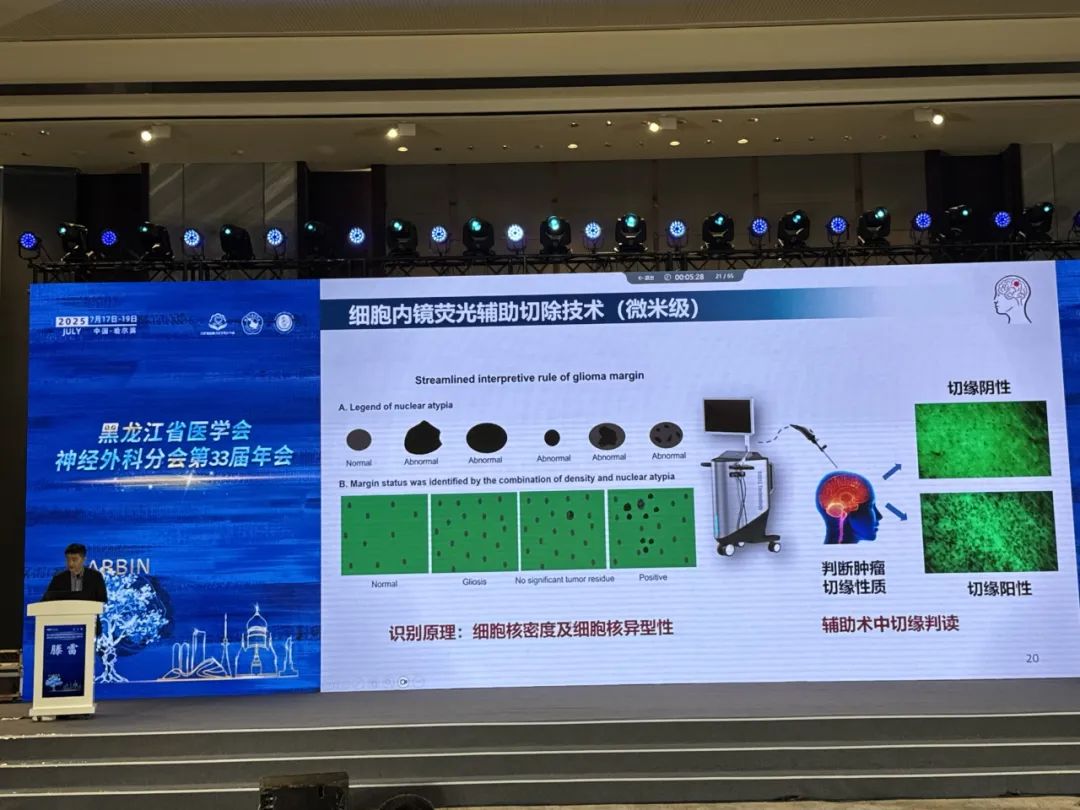 第三屆寒地夏都神經(jīng)腫瘤論壇：EndoSCell?推動術(shù)中熒光顯影技術(shù)邁入“細(xì)胞熒光”時代(圖5)