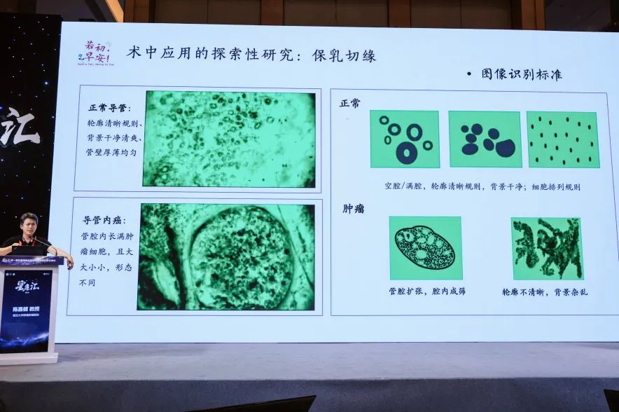 細(xì)胞級(jí)熒光導(dǎo)引技術(shù)亮相沈陽(yáng)乳腺癌論壇，EndoSCell?破解術(shù)中切緣判讀難題(圖6)