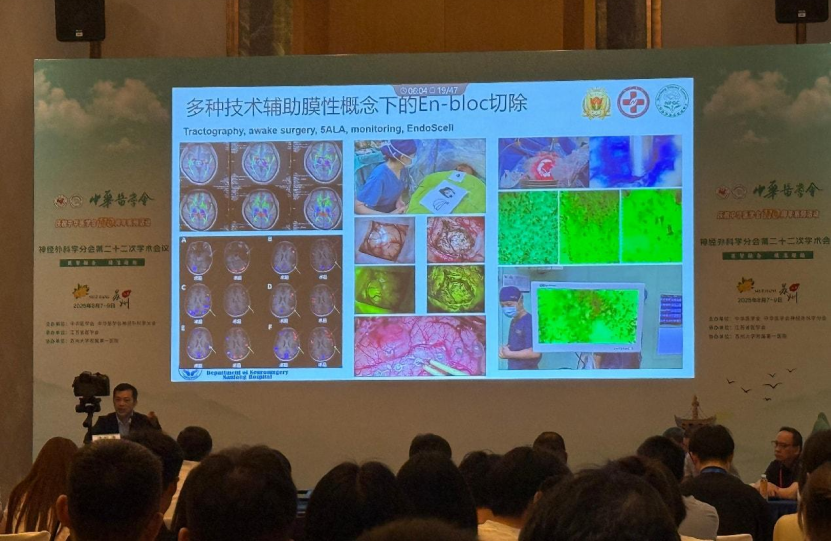 中華醫(yī)學(xué)會(huì)神經(jīng)外科學(xué)分會(huì)第二十二次學(xué)術(shù)會(huì)議在蘇召開：細(xì)胞級(jí)熒光導(dǎo)引技術(shù)引領(lǐng)神經(jīng)外科手術(shù)邁入精準(zhǔn)可視化新時(shí)代(圖9)